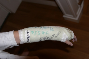 Broken ARm